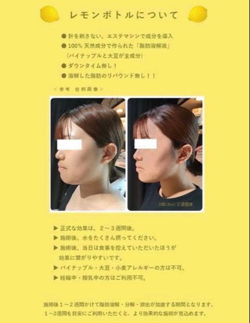 くじら　レモンボトル×3本