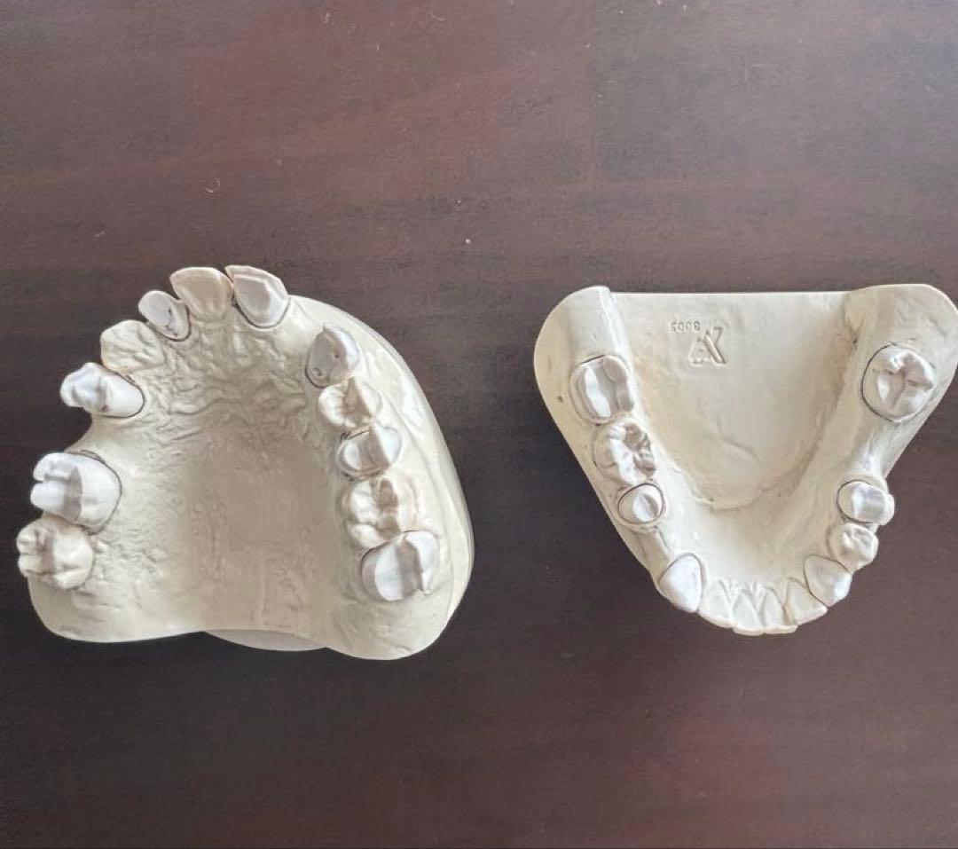 最終価格　歯科　支台歯形成　練習模型　セット