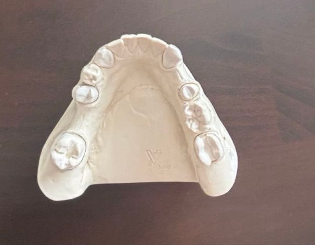 最終価格　歯科　支台歯形成　練習模型　セット