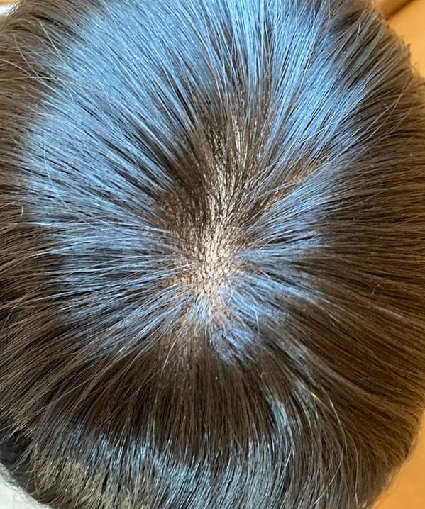 リネアストリア　人毛MIX「天使のブリティッシュショート」M　ブラック