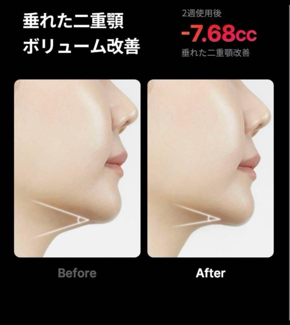 年末sale✨新品未開封 ⭐️medicube⭐️ハイフォーカスショット⭐️